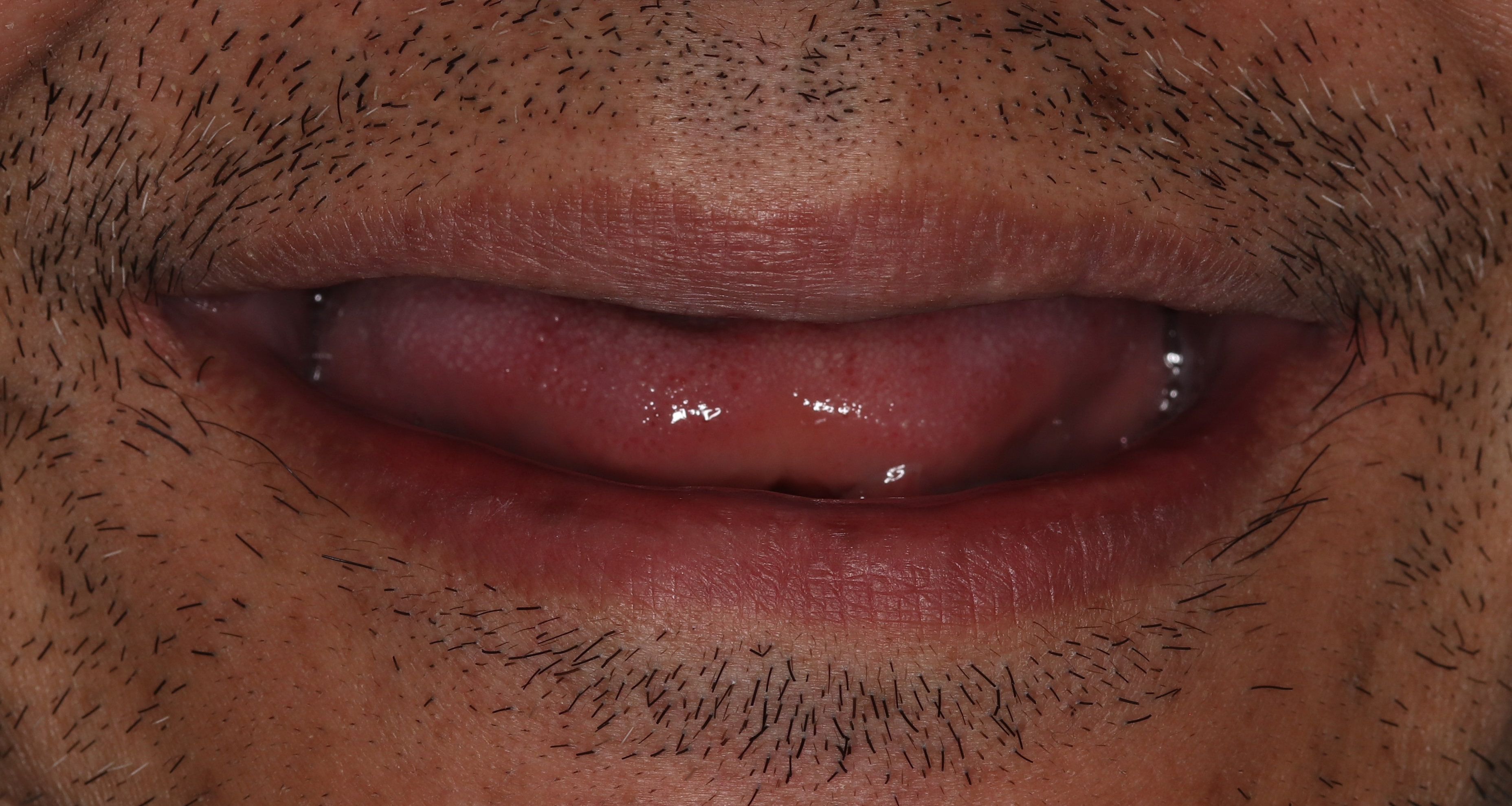 Before